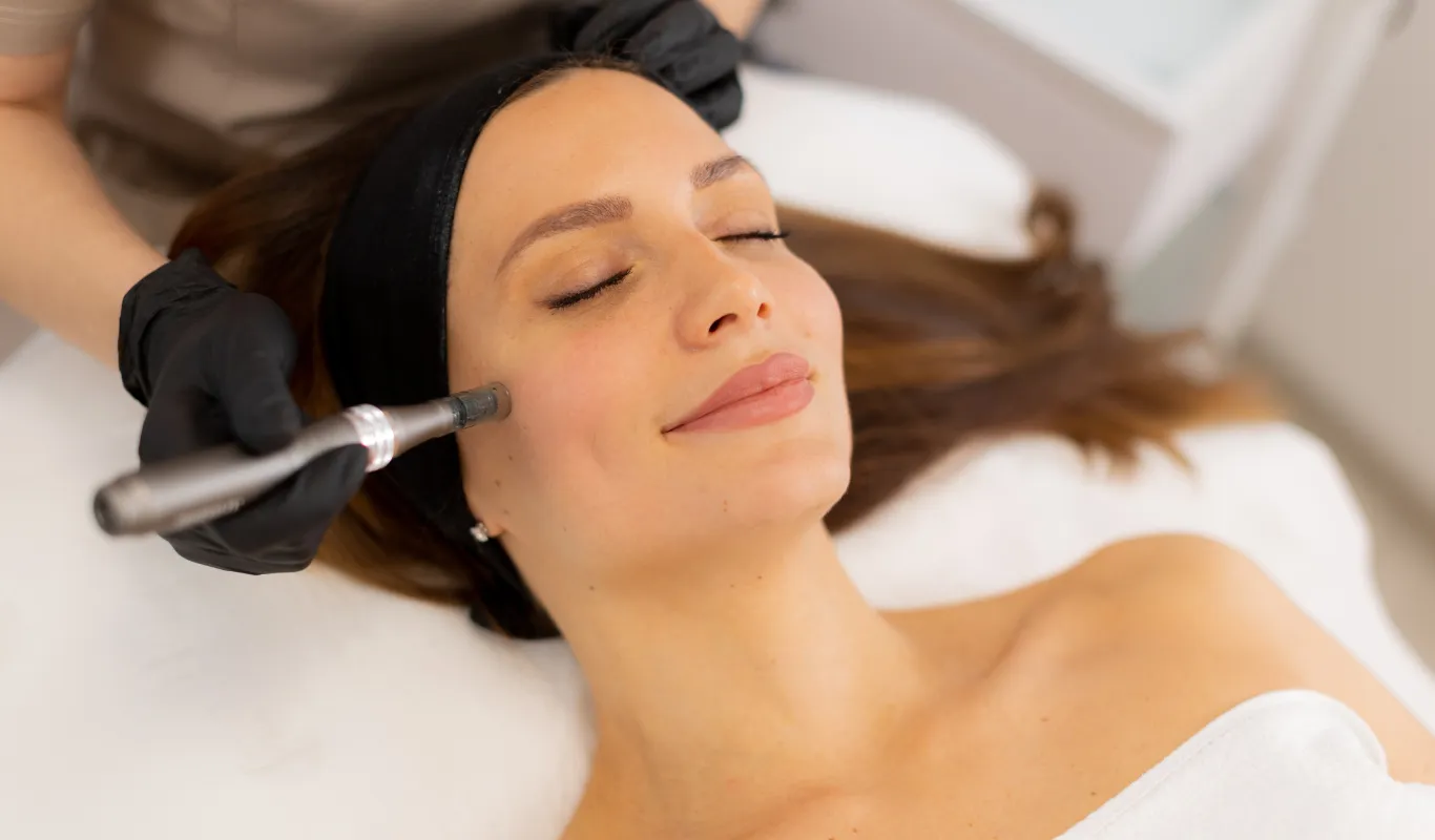 Aplicación de mesoterapia facial FILORGA NCTF en Novastética Bogotá